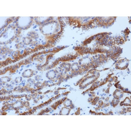 Immunohistochemistry - Anti-TSH Receptor Antibody [SPM222] (A250221) - Antibodies.com