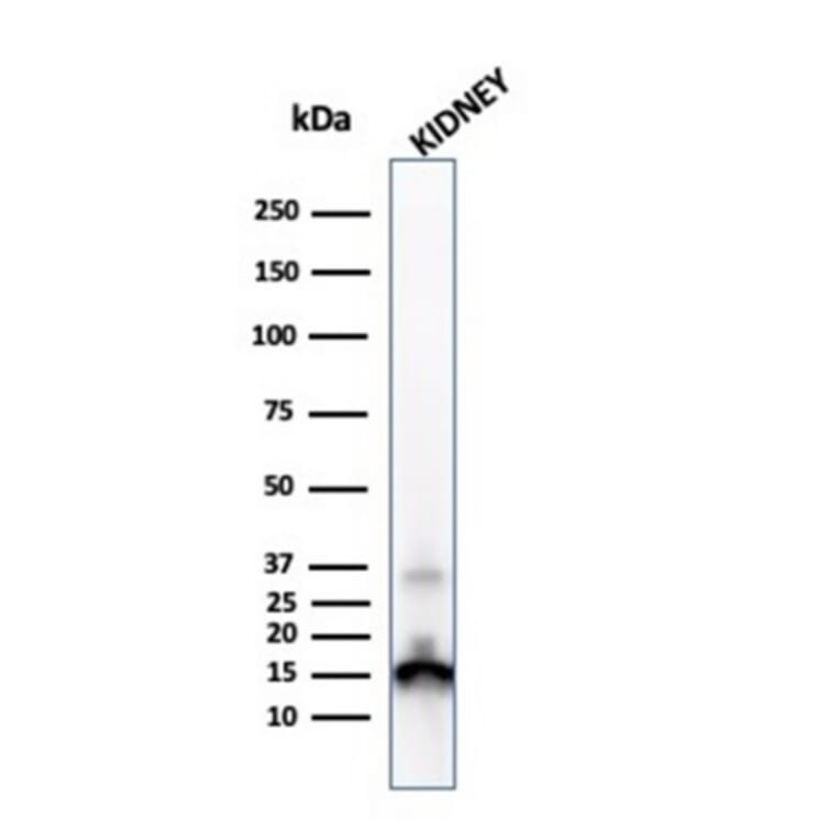 Western Blot - Anti-Transthyretin Antibody [CPTC-TTR-1] (A250223) - Antibodies.com