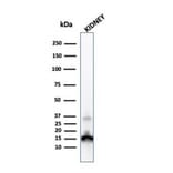 Western Blot - Anti-Transthyretin Antibody [CPTC-TTR-1] (A250223) - Antibodies.com