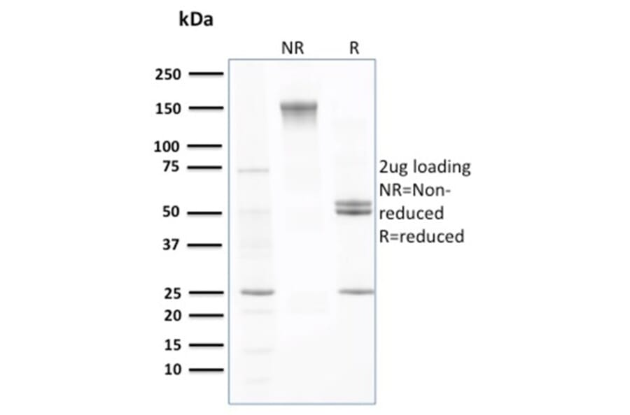 SDS-PAGE - Anti-Transthyretin Antibody [CPTC-TTR-1] (A250223) - Antibodies.com