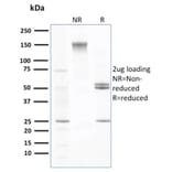 SDS-PAGE - Anti-Transthyretin Antibody [CPTC-TTR-1] (A250223) - Antibodies.com