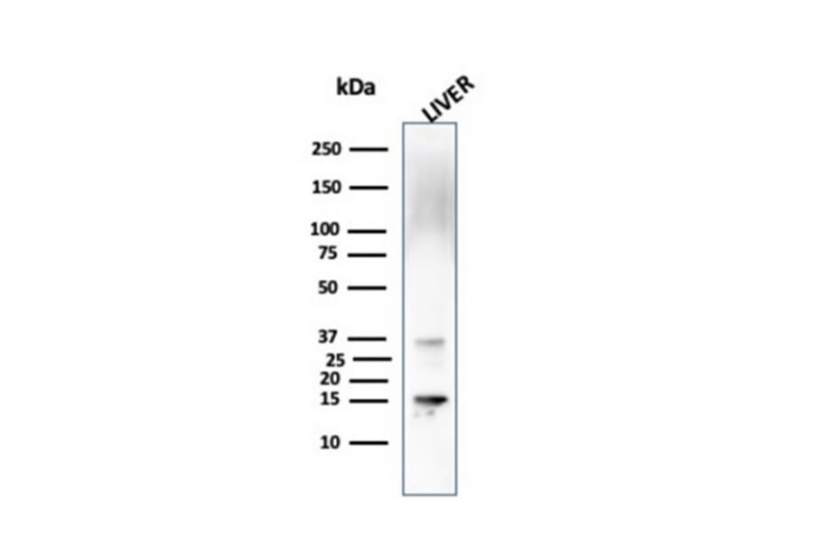 Western Blot - Anti-Transthyretin Antibody [CPTC-TTR-1] (A250223) - Antibodies.com