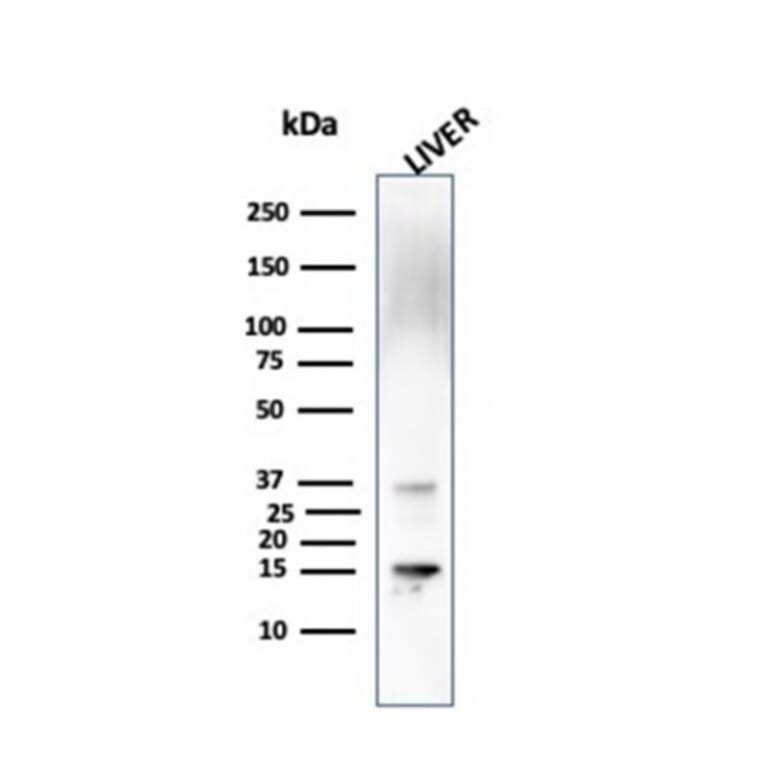 Western Blot - Anti-Transthyretin Antibody [CPTC-TTR-1] (A250223) - Antibodies.com