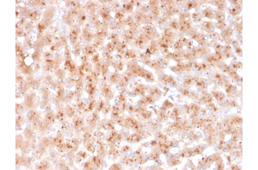 Immunohistochemistry - Anti-Transthyretin Antibody [TTR/4292] (A250224) - Antibodies.com