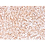 Immunohistochemistry - Anti-Transthyretin Antibody [TTR/4292] (A250224) - Antibodies.com