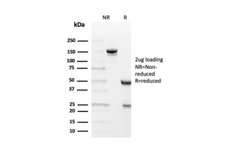 SDS-PAGE - Anti-Transthyretin Antibody [TTR/4292] (A250224) - Antibodies.com
