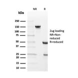 SDS-PAGE - Anti-Transthyretin Antibody [TTR/4292] (A250224) - Antibodies.com