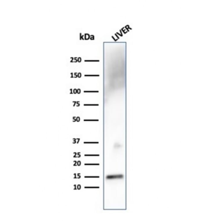 Western Blot - Anti-Transthyretin Antibody [TTR/4292] (A250224) - Antibodies.com