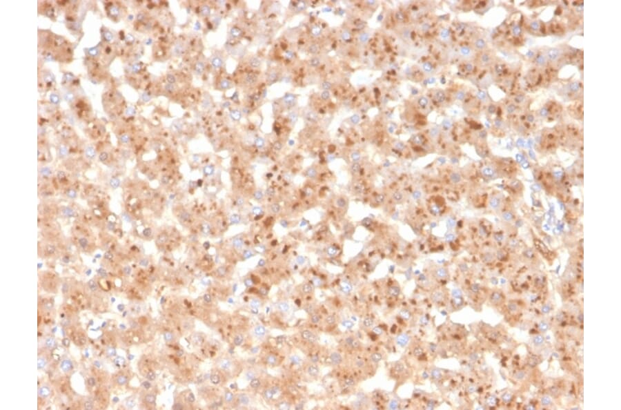 Immunohistochemistry - Anti-Transthyretin Antibody [TTR/4293] (A250225) - Antibodies.com