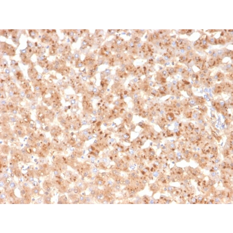 Immunohistochemistry - Anti-Transthyretin Antibody [TTR/4293] (A250225) - Antibodies.com