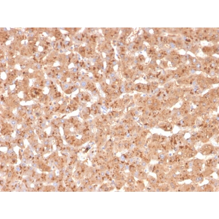 Immunohistochemistry - Anti-Transthyretin Antibody [TTR/4295] (A250226) - Antibodies.com