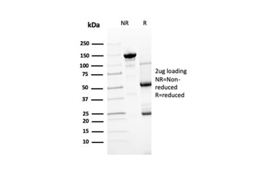 SDS-PAGE - Anti-Transthyretin Antibody [TTR/4295] (A250226) - Antibodies.com