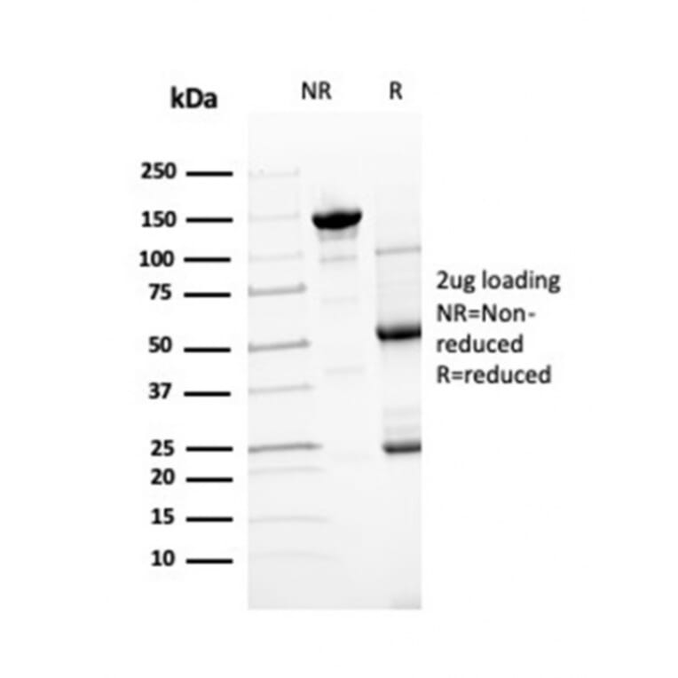 SDS-PAGE - Anti-Transthyretin Antibody [TTR/4295] (A250226) - Antibodies.com