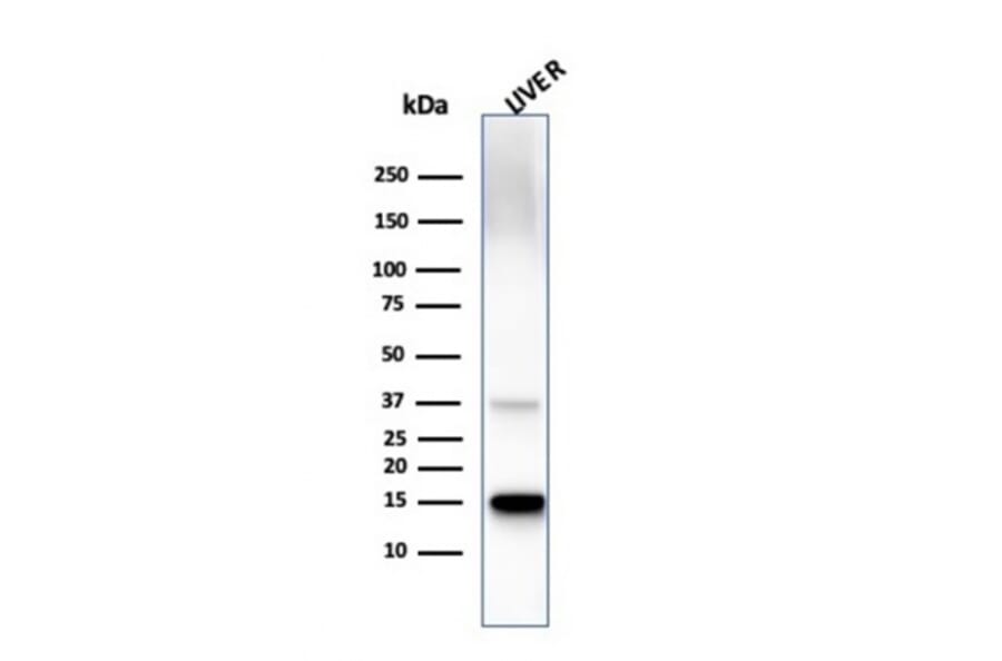 Western Blot - Anti-Transthyretin Antibody [TTR/4295] (A250226) - Antibodies.com