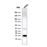 Western Blot - Anti-Transthyretin Antibody [TTR/4295] (A250226) - Antibodies.com