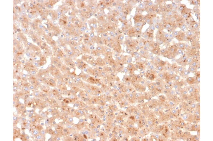 Immunohistochemistry - Anti-Transthyretin Antibody [TTR/4296] (A250227) - Antibodies.com