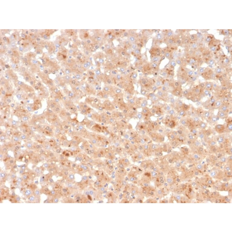 Immunohistochemistry - Anti-Transthyretin Antibody [TTR/4296] (A250227) - Antibodies.com