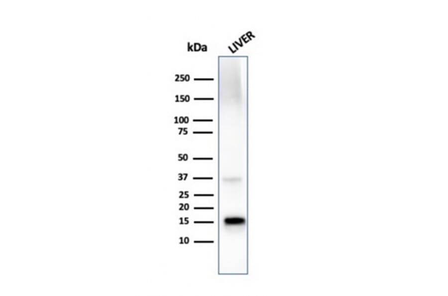 Western Blot - Anti-Transthyretin Antibody [TTR/4296] (A250227) - Antibodies.com