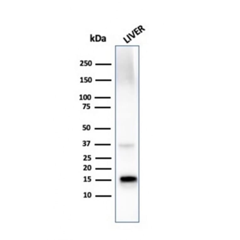 Western Blot - Anti-Transthyretin Antibody [TTR/4296] (A250227) - Antibodies.com