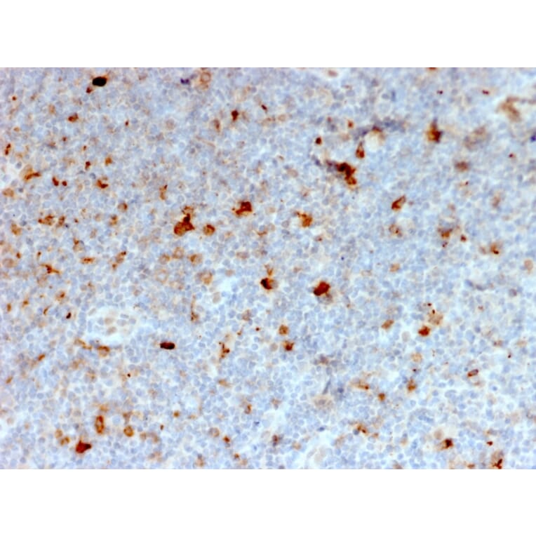 Immunohistochemistry - Anti-CD134 Antibody [OX40/2721] (A250229) - Antibodies.com