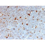 Immunohistochemistry - Anti-CD134 Antibody [OX40/2721] (A250229) - Antibodies.com
