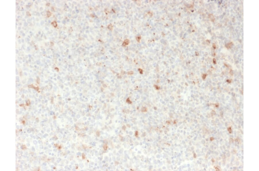 Immunohistochemistry - Anti-CD134 Antibody [OX40/2721] (A250229) - Antibodies.com