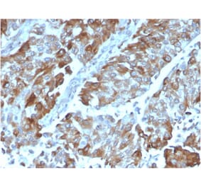 Immunohistochemistry - Anti-CD134 Antibody [OX40/3108] (A250230) - Antibodies.com