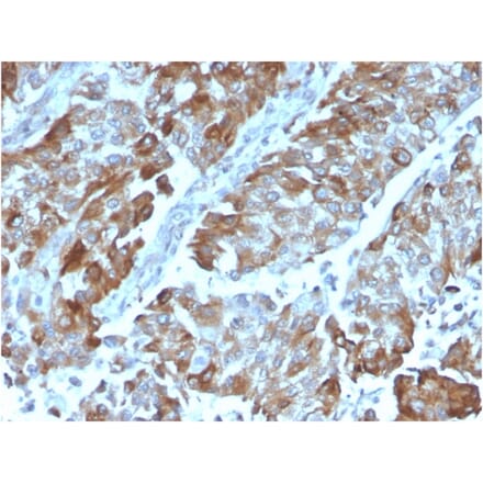 Immunohistochemistry - Anti-CD134 Antibody [OX40/3108] (A250230) - Antibodies.com