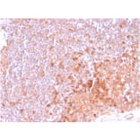 Immunohistochemistry - Anti-CD134 Antibody [OX40/3108] (A250230) - Antibodies.com