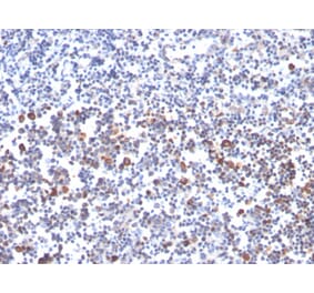 Immunohistochemistry - Anti-CD134 Antibody [OX40/3427] (A250231) - Antibodies.com