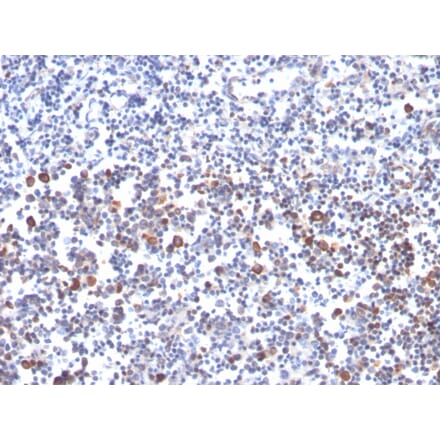 Immunohistochemistry - Anti-CD134 Antibody [OX40/3427] (A250231) - Antibodies.com
