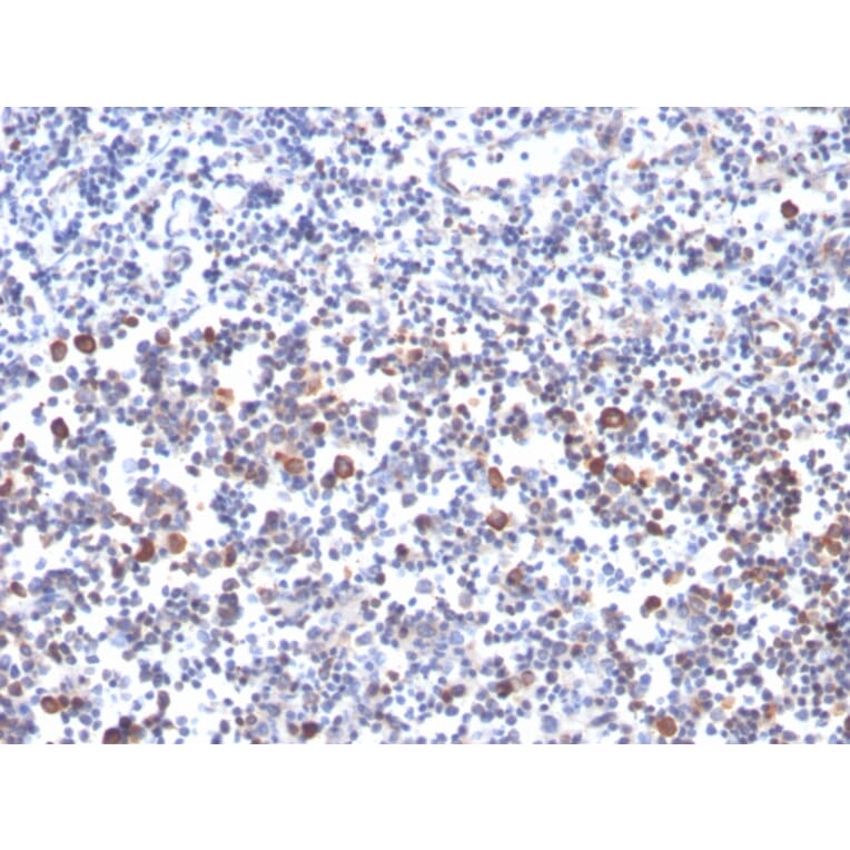 Immunohistochemistry - Anti-CD134 Antibody [OX40/3427] (A250231) - Antibodies.com