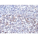 Immunohistochemistry - Anti-CD134 Antibody [OX40/3427] (A250231) - Antibodies.com