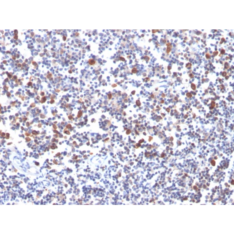 Immunohistochemistry - Anti-CD134 Antibody [OX40/3427] (A250231) - Antibodies.com
