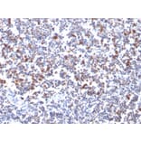 Immunohistochemistry - Anti-CD134 Antibody [OX40/3427] (A250231) - Antibodies.com