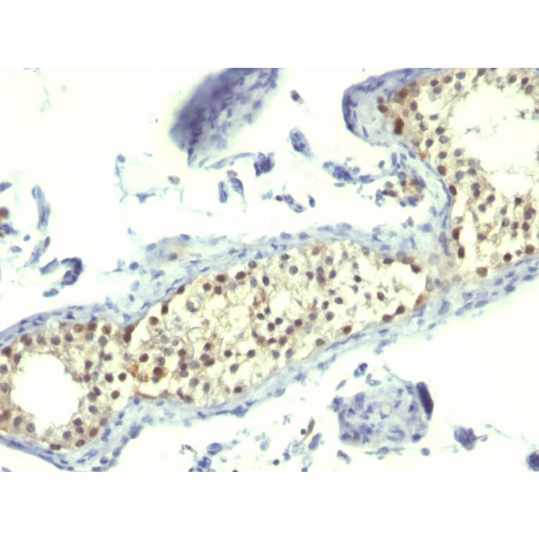 Immunohistochemistry - Anti-Thymidylate Synthase Antibody [TS106] (A250232) - Antibodies.com