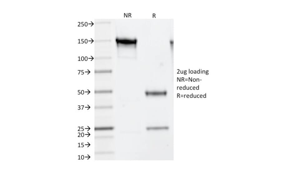 SDS-PAGE - Anti-Thymidylate Synthase Antibody [TS106] (A250233) - Antibodies.com