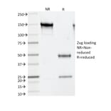 SDS-PAGE - Anti-Thymidylate Synthase Antibody [TS106] (A250233) - Antibodies.com