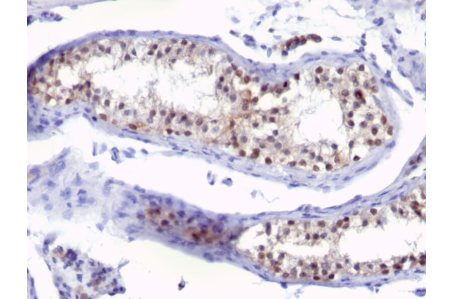 Immunohistochemistry - Anti-Thymidylate Synthase Antibody [SPM453] (A250233) - Antibodies.com