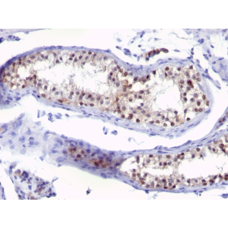 Immunohistochemistry - Anti-Thymidylate Synthase Antibody [SPM453] (A250233) - Antibodies.com