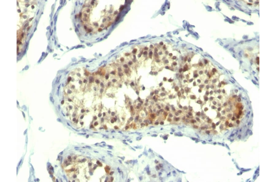 Immunohistochemistry - Anti-Thymidylate Synthase Antibody [TMS715] (A250234) - Antibodies.com