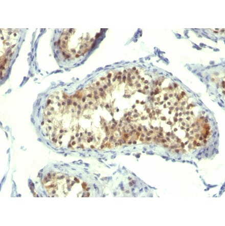 Immunohistochemistry - Anti-Thymidylate Synthase Antibody [TMS715] (A250234) - Antibodies.com