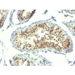 Immunohistochemistry - Anti-Thymidylate Synthase Antibody [TMS715] (A250234) - Antibodies.com