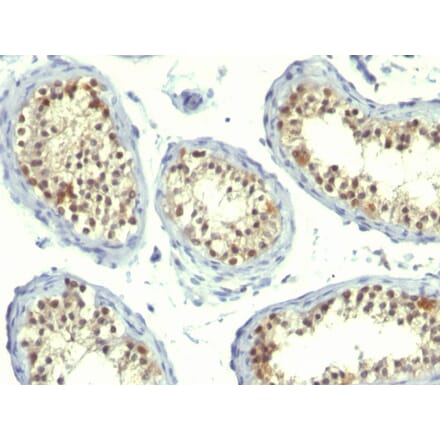 Immunohistochemistry - Anti-Thymidylate Synthase Antibody [TS106 + TMS715] (A250235) - Antibodies.com