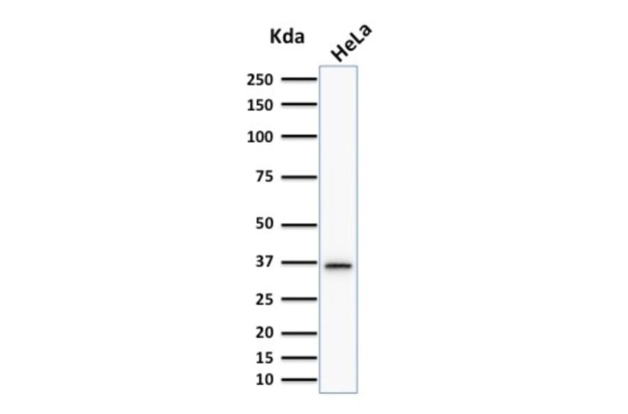 Western Blot - Anti-Thymidylate Synthase Antibody [TYMS/1884] (A250237) - Antibodies.com
