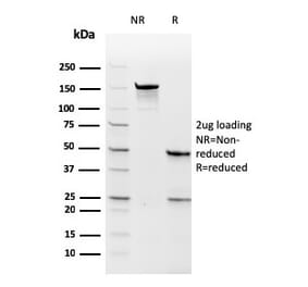 SDS-PAGE - Anti-Thymidylate Synthase Antibody [rTYMS/1884] (A250238) - Antibodies.com