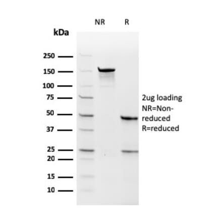 SDS-PAGE - Anti-Thymidylate Synthase Antibody [rTYMS/1884] (A250238) - Antibodies.com