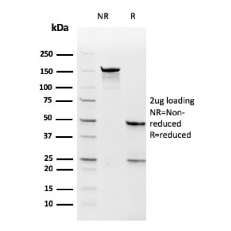 SDS-PAGE - Anti-Thymidylate Synthase Antibody [rTYMS/1884] (A250238) - Antibodies.com