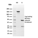 SDS-PAGE - Anti-Thymidylate Synthase Antibody [rTYMS/1884] (A250238) - Antibodies.com