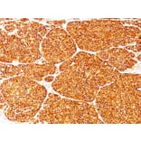 Immunohistochemistry - Anti-Tyrosinase Antibody [T311] (A250239) - Antibodies.com